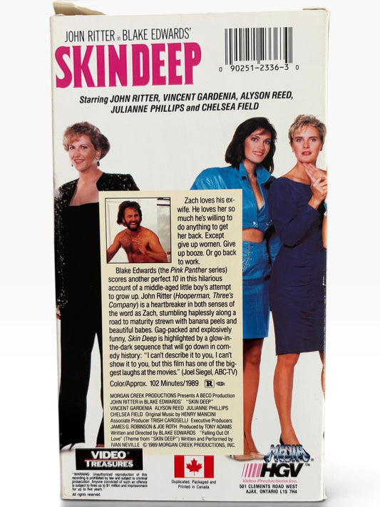 Skin Deep (1989)