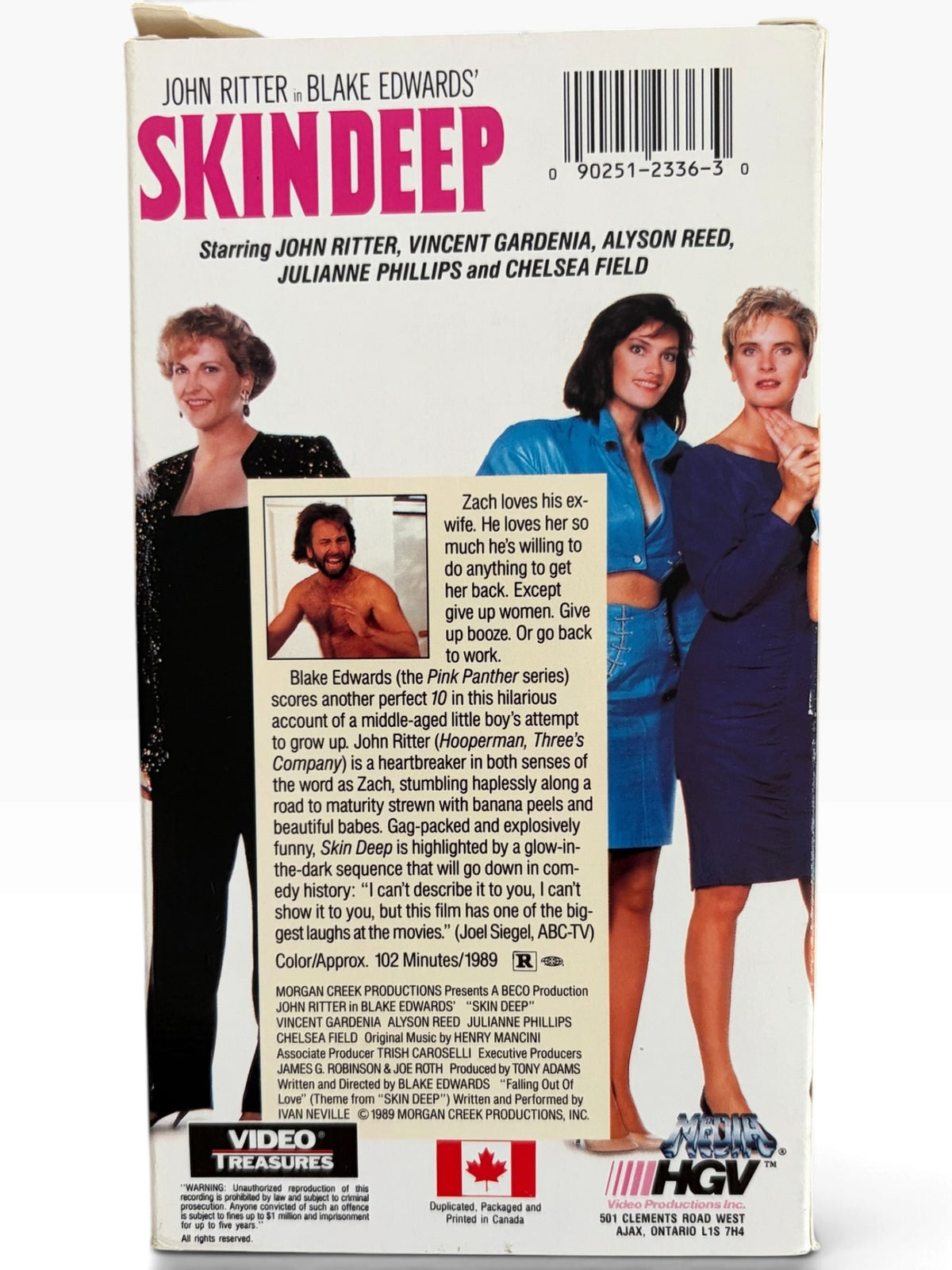 Skin Deep (1989)